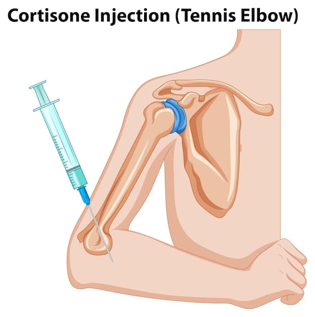 A detailed medical illustration showing a peripheral nerve block procedure, with a needle precisely injecting medication near a nerve bundle. The illustration uses transparent layers to show underlying anatomy and the spread of anesthetic.